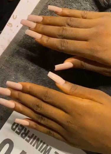 After Nail Transformation